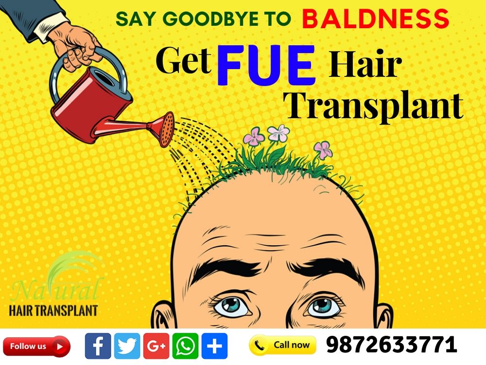 say Good bye To Baldness  Get FUE hair... - Natural Hair Transplant | Facebook