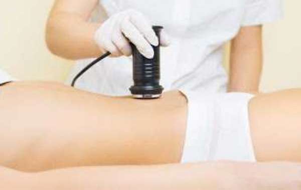 Best Alternatives to Liposuction