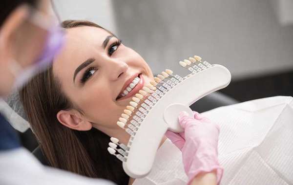 Bring Back your Smile with a Dental Crown in Houston