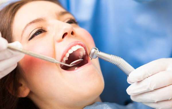 The Best Dental Crowns in Houston