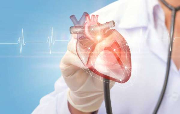 Mengenal Keunggulan Intervensi Kardiologi Dibandingkan Prosedur Bedah Konvensional