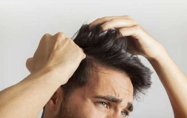 Which Doctor is Best for Hair Loss?
