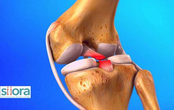 Posterior Cruciate Ligament Injury - What You Must Know
