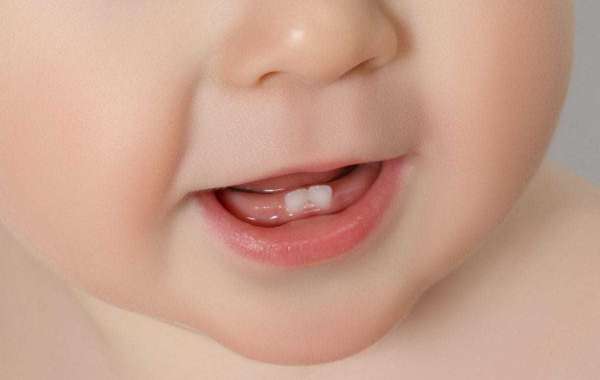 Managing Oral Hygiene in Infants