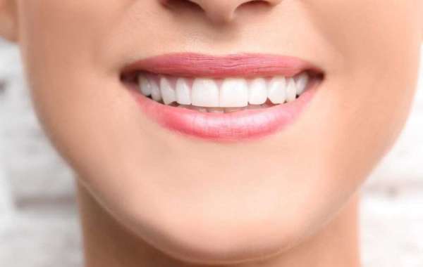 Tooth Bonding for Cosmetic Purposes | My Primary Dental