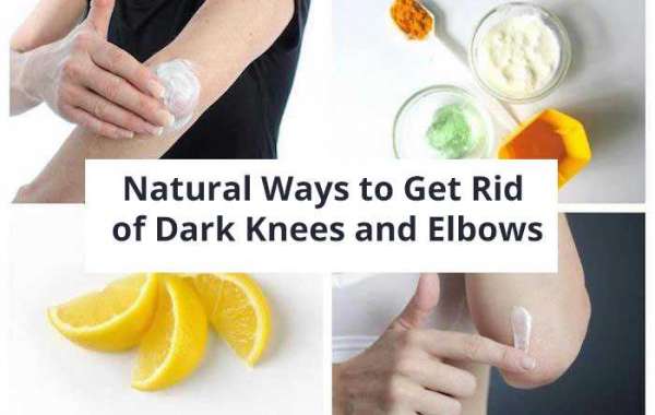 Natural Remedies for Dark Knees and Elbows