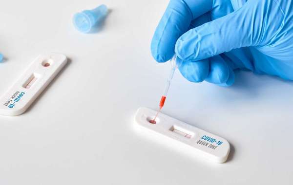 What is RT-PCR Test?