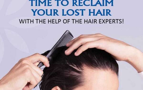 PRP Hair Loss Treatment in Delhi