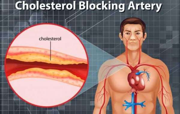 How To Know High Cholesterol