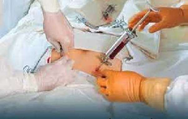 What Are the Complications We Can Face After a Bone Marrow Transplant?
