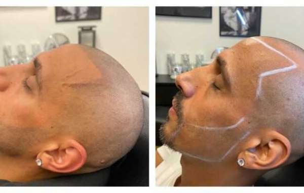 Get Effect Hair Treatment at Affordable Prices from Made Hair Academy