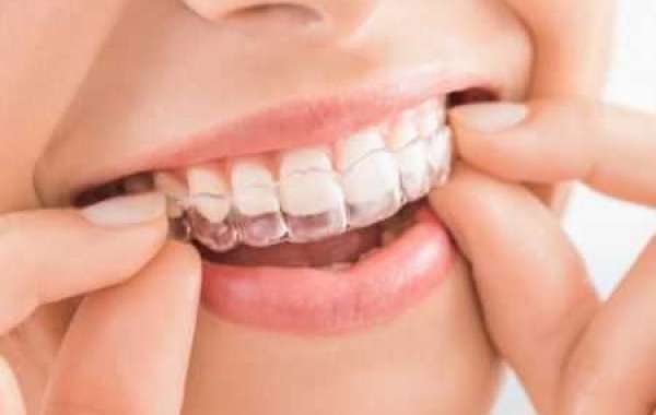 Why should you consider Invisalign, and can you get the best Invisalign in Toronto?
