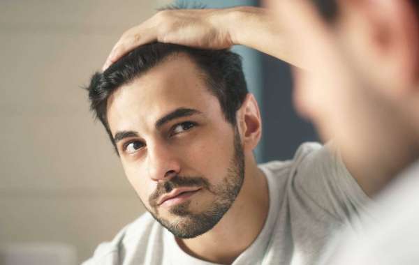 Hair Loss Treatment for Men