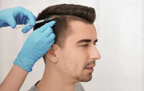 How Does Hair Transplantation Work?