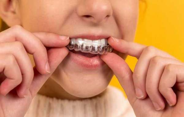 removable retainer cost in india