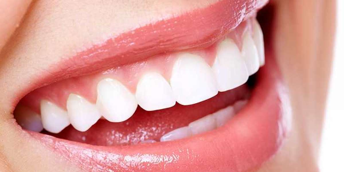 What to Expect with Dental Fillings