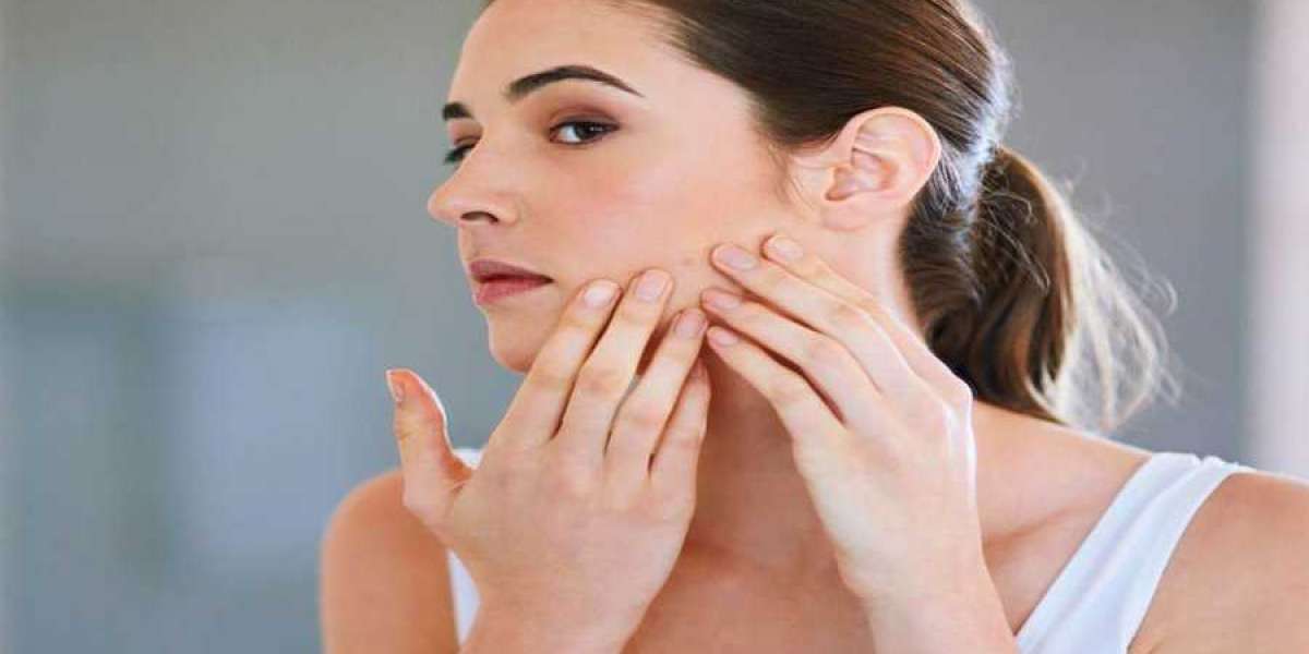 Why You Should Invest In Acne Scar Treatment In Delhi