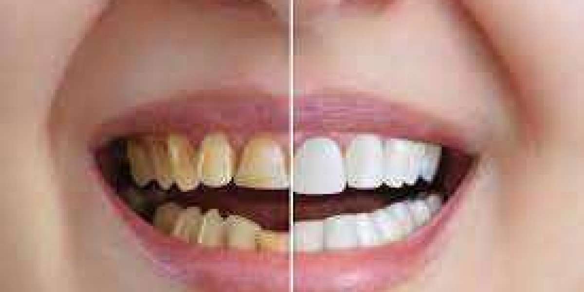 COSMETIC DENTISTRY ETOBICOKE