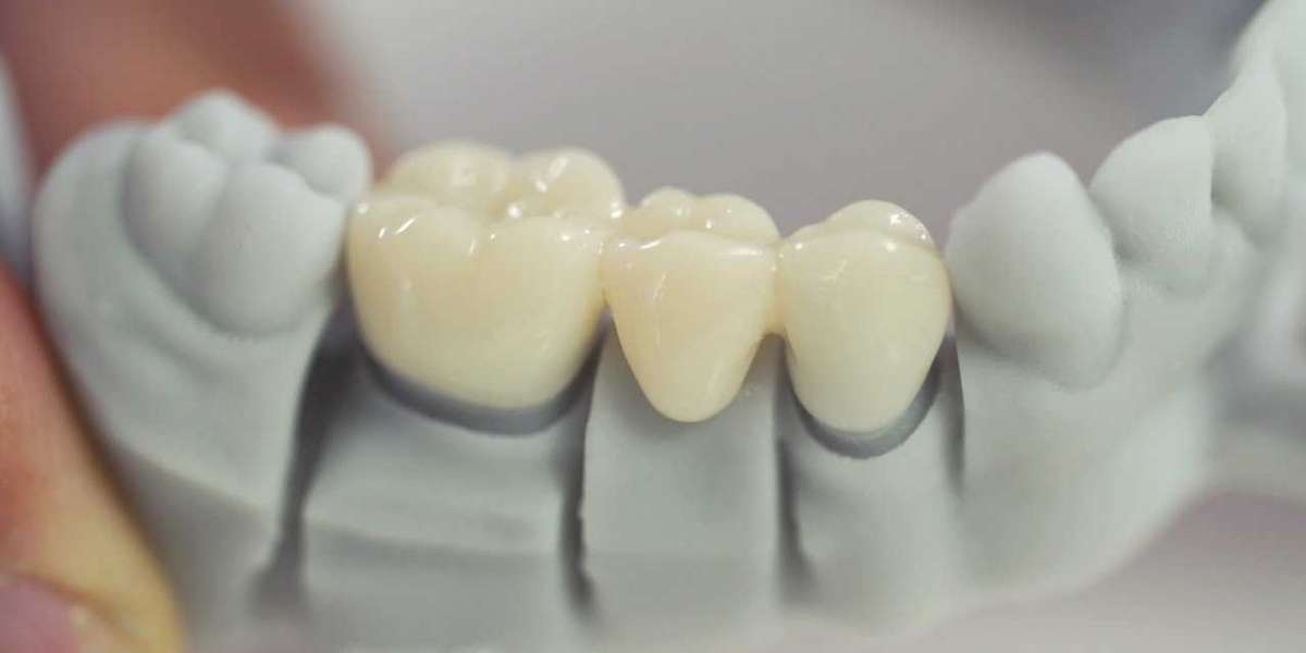 Dental 3D Printer Market Analysis, Size, Share, Growth, Trends, and Forecast till 2028