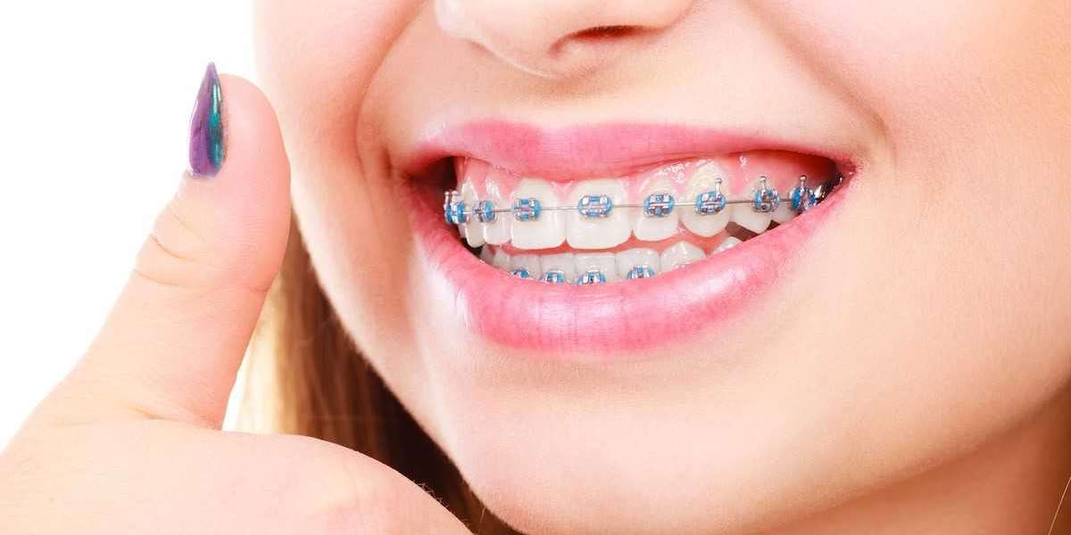 Orthodontist Melbourne