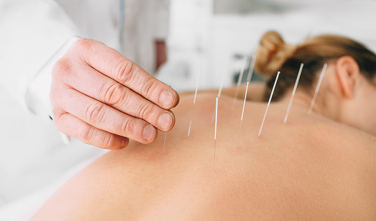 How To Be Ready for A Session of Acupuncture for Low Back Pain