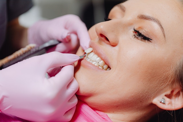 Knowing 7 Things Before Choosing Veneers!