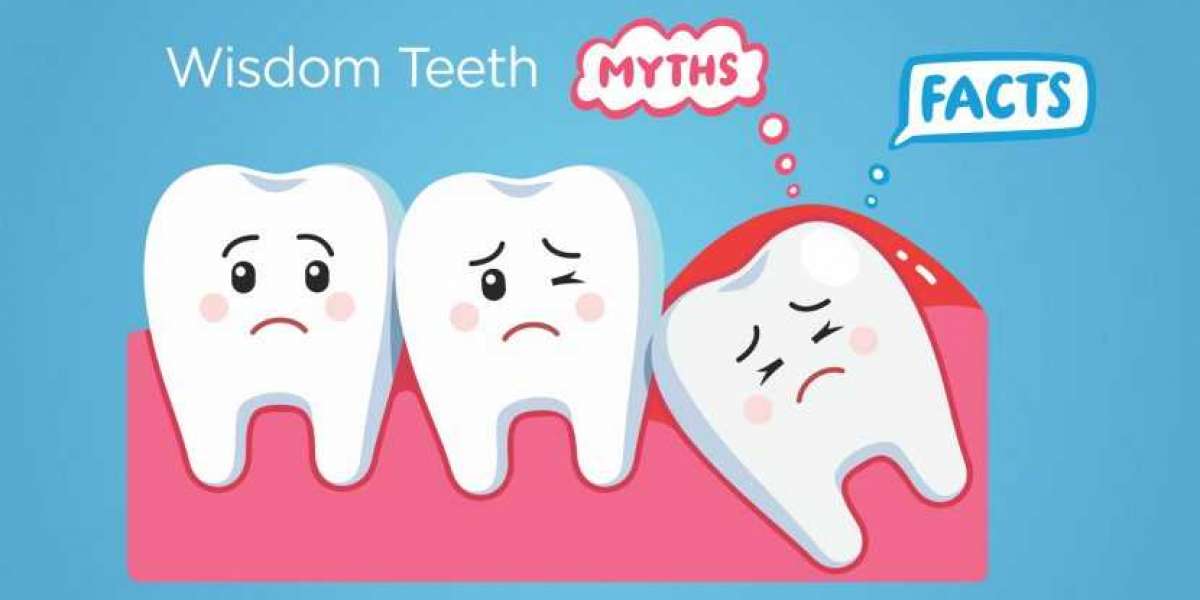 Myths vs. Facts Regarding Wisdom Teeth