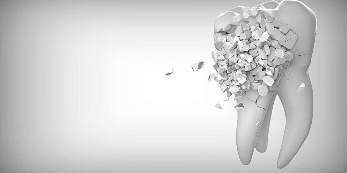 What is an abutment in dentistry?