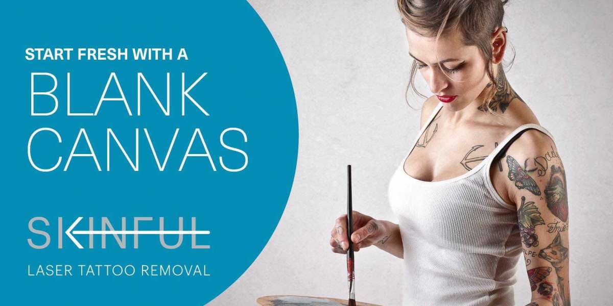 How to Choose a Tattoo Removal Clinic