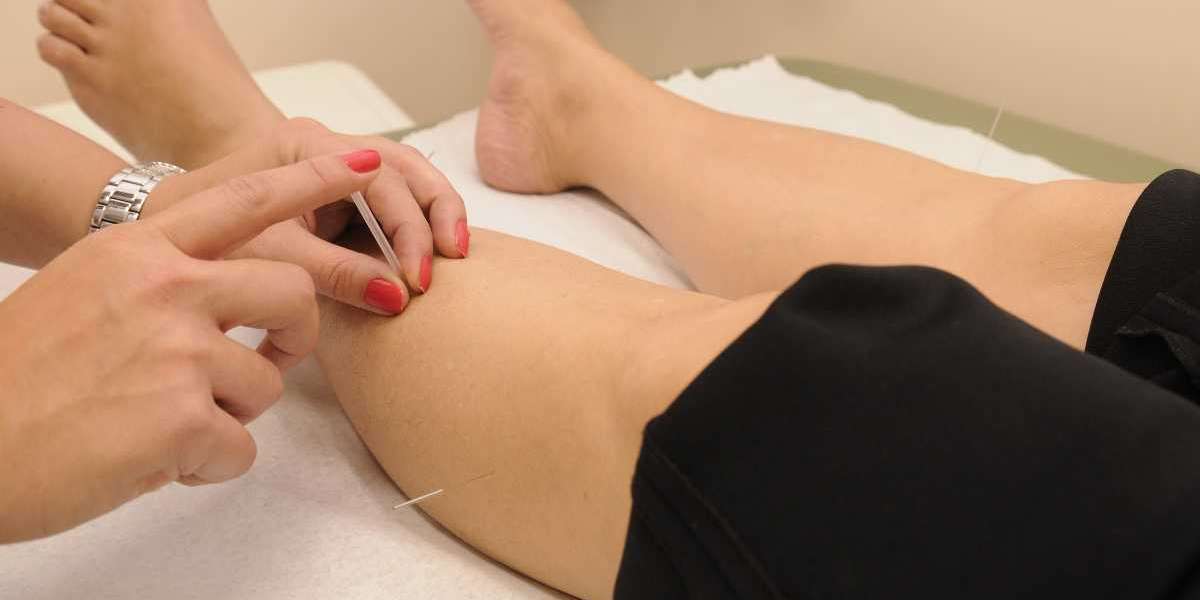 How Acupuncture and Physical Therapy Can Improve Mobility and Range of Motion