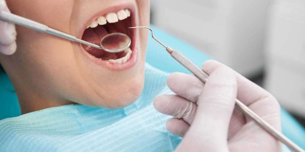 Dental Fillings: Everything You Need to Know