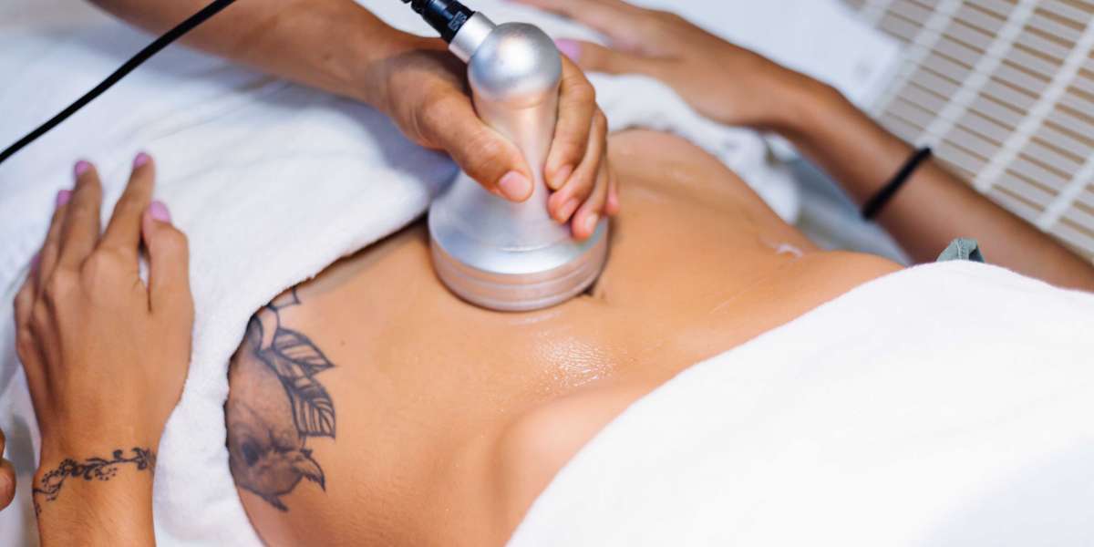 Cost of Lipo Cavitation