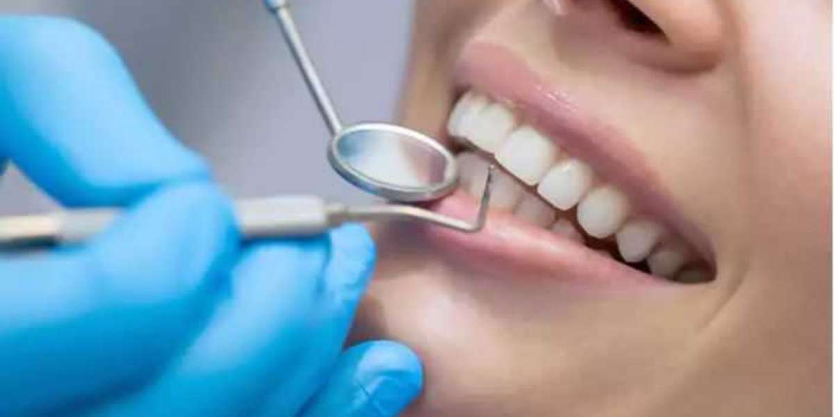 Cracking And Staining? 5 Habits That Ruin Our Teeth