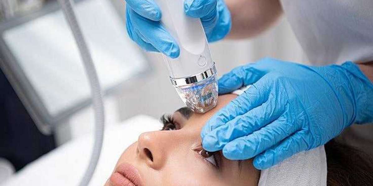 Firm, Tight, and Radiant | Microneedling with RF Benefits Revealed