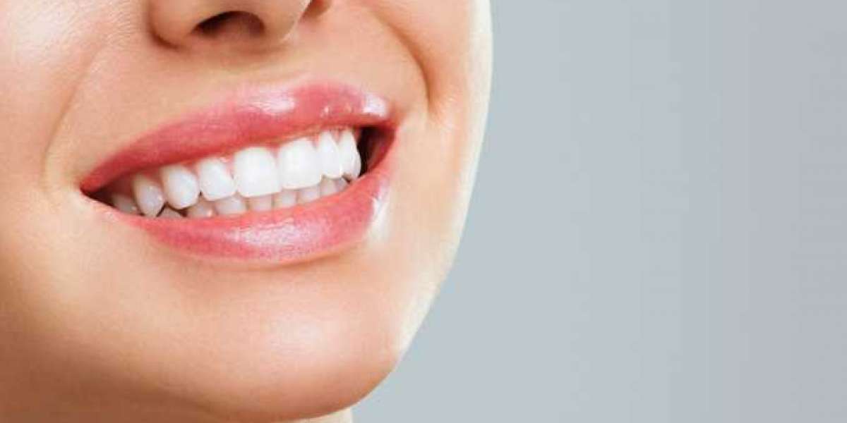 Achieve Dazzling Smiles with Zoom Teeth Whitening at New Ivory Dental Clinic in Dubai