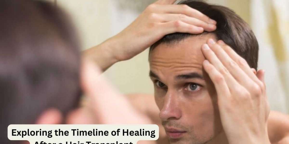 Exploring the Timeline of Healing After a Hair Transplant