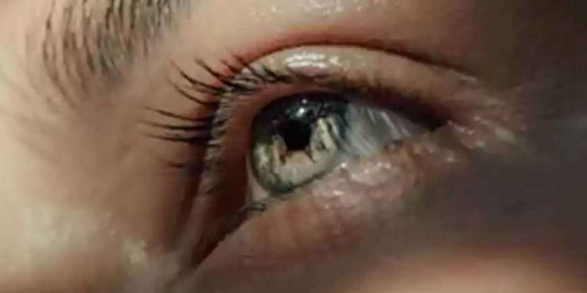 What should you do if crackers cause an eye injury?