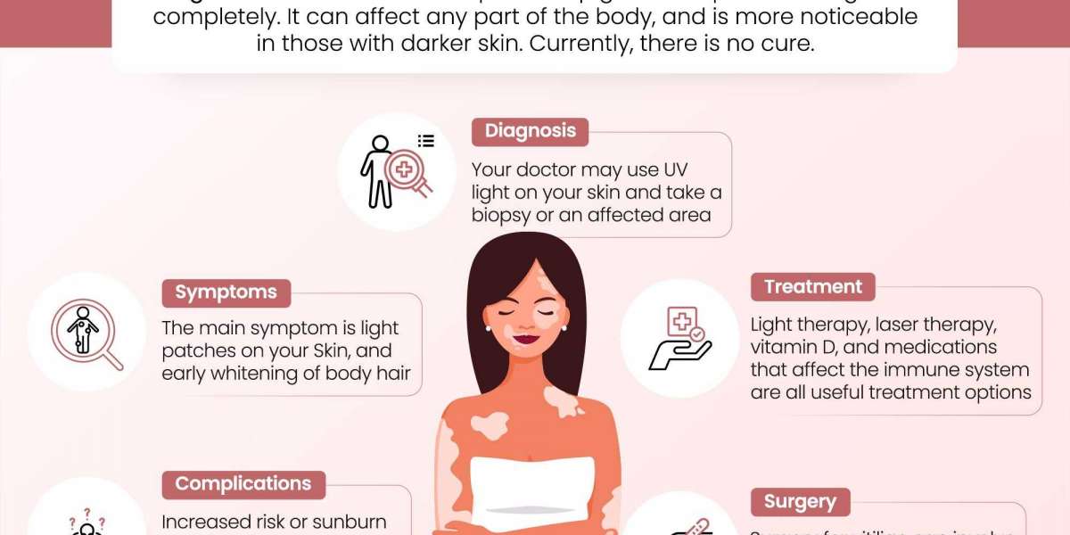 Vitiligo Treatment in Ludhiana: Consult Dr. Shikha Aggarwal