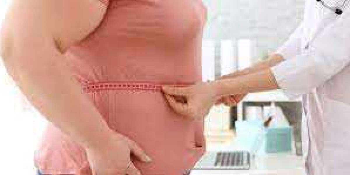 The Weight Loss Revolution Bariatric Surgery in Riyadh Unveiled