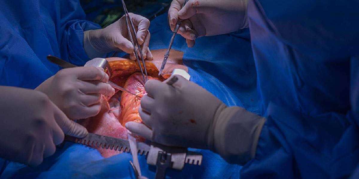 Understanding the Life-Saving Benefits and Techniques of Open-Heart Surgery