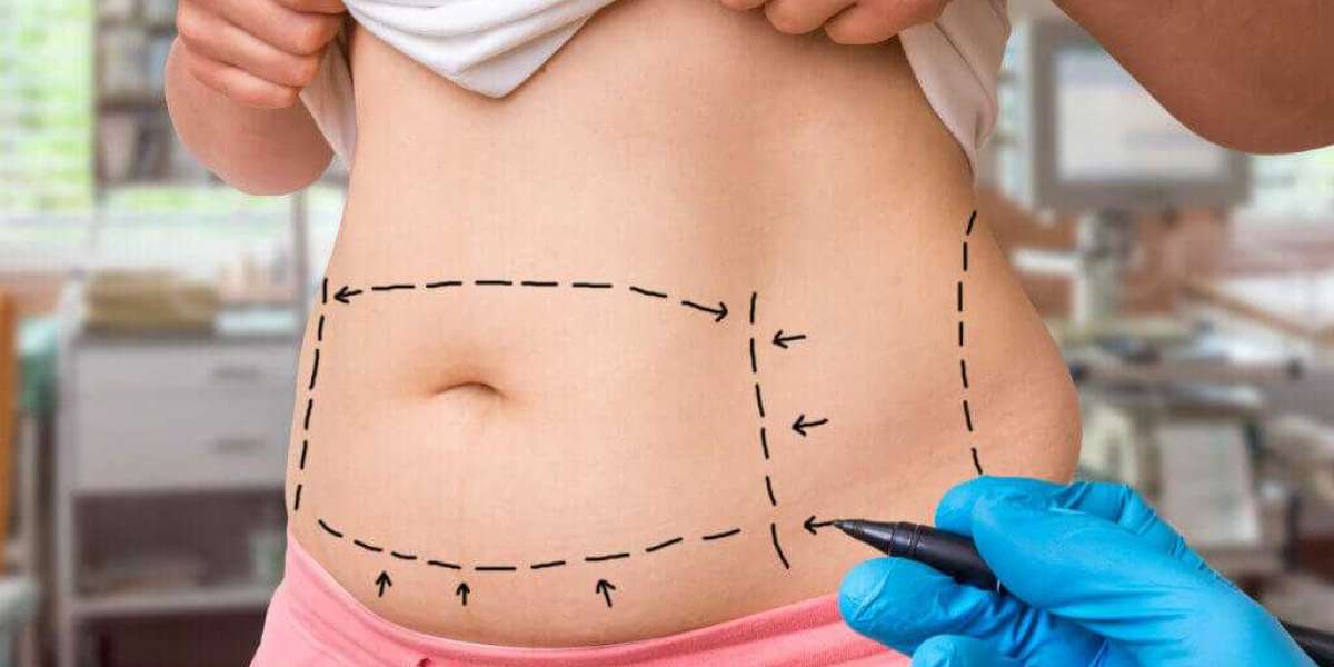 Body Contouring Excellence Riyadh's Best 4D Liposuction Clinic