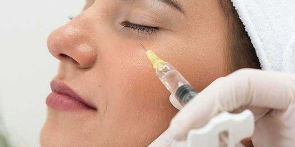 How Botox Works: A Step-by-Step Guide to Botox Injections in Riyadh
