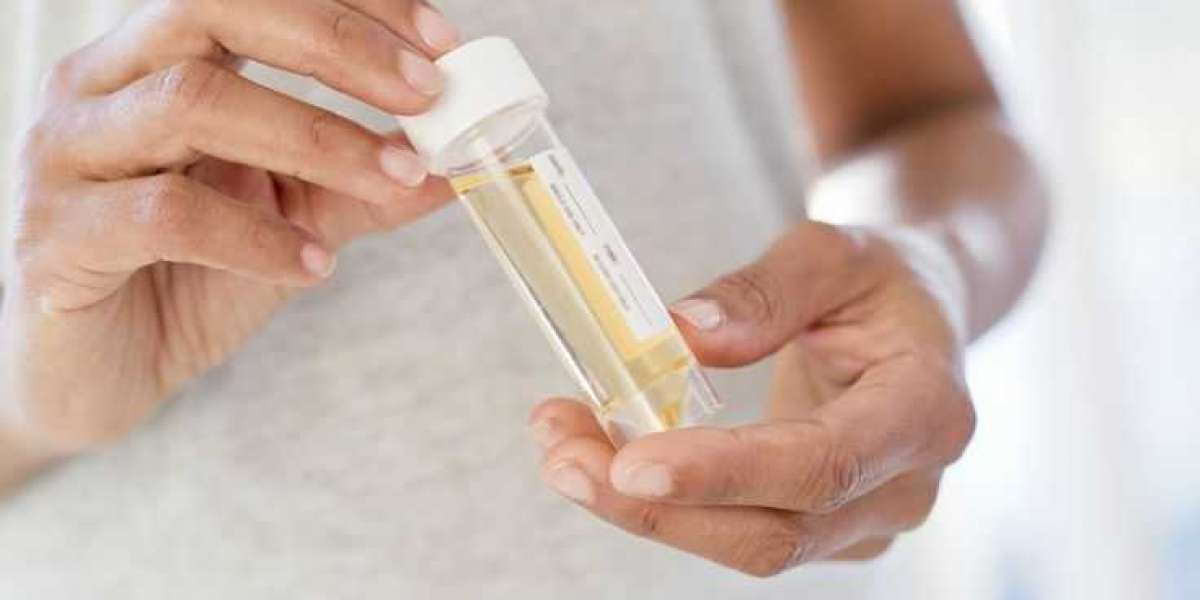 How Can Patients Provide a High-Quality Urine Sample for Accurate Test Results?