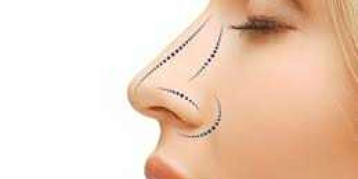 Transform Your Face & Life: The Surprising Beauty Benefits of Rhinoplasty