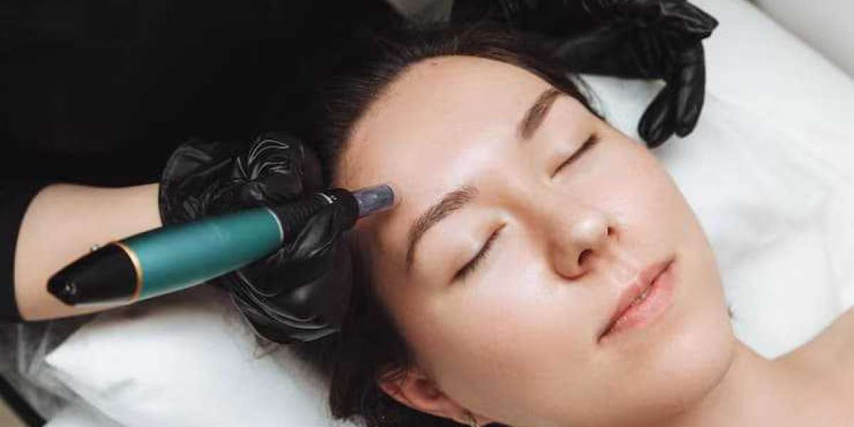 Renewed Skin, Renewed Confidence: Exploring the Benefits of Microneedling in Leicester