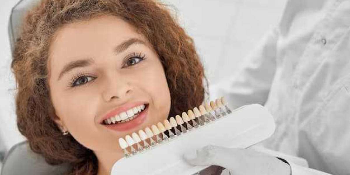 Natural Looking Veneers: The Key to a Subtle Transformation